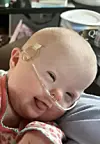 Infant with Down syndrome smiling with medical equipment.