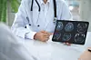 Doctor showing brain scans to a patient.