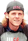Close-up of a young man wearing a gray cap with “SKINS” on the front.