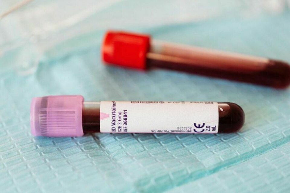 Elements of the blood profile include a cholesterol lipid panel for HDL, LDL and triglycerides; a comprehensive metabolic panel for kidney and liver function and blood glucose; a complete blood count test for anemia, infection and immunity; and a TSH to measure thyroid function. Annual Spring Healthcheck is coming